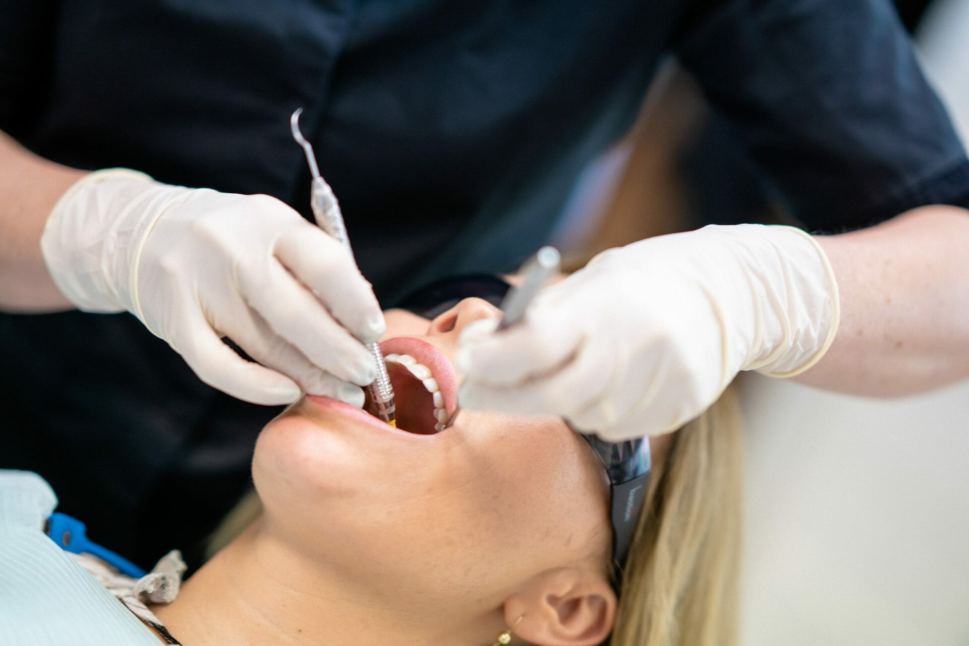 Dental Fillings Mosman Fine Dental (Book Now)